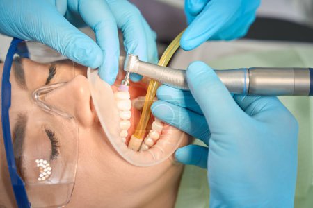 Foto de Primer plano de las manos higienistas dentales en guantes de nitrilo pulido de dientes delanteros femeninos con cepillo de cerdas de nylon - Imagen libre de derechos