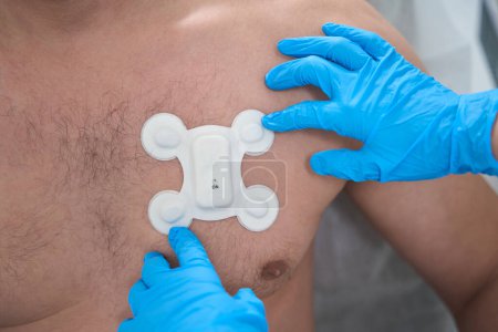 Foto de Doctor glues the electrode to the chest of a man with a naked torso, for diagnostic ECG - electrocardiography - Imagen libre de derechos