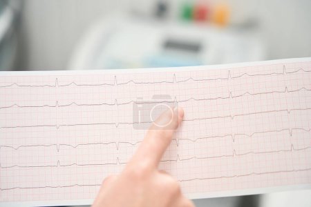 Foto de Close up picture of detail result heartbeat examining in the medicine center - Imagen libre de derechos