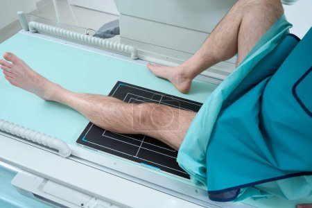 Foto de Paciente masculino sentado en la cama antes de una radiografía de rodilla en el hospital. Equipos modernos en la clínica - Imagen libre de derechos