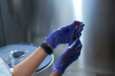 Photo for Female hands of a health worker in latex gloves is holding a test tube with blood in it - Royalty Free Image