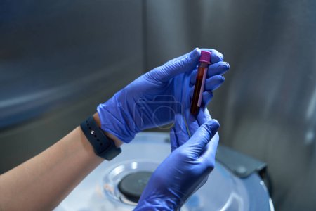 Téléchargez les photos : Photo recadrée d'un travailleur de la santé dans des gants en latex tenant un tube à essai avec du sang dedans - en image libre de droit