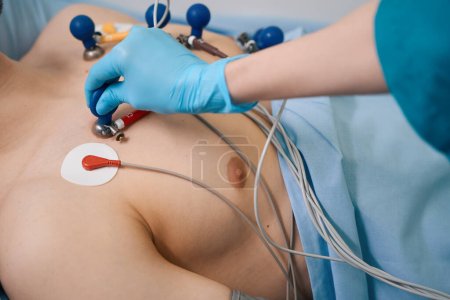 Trabajador médico en guantes de protección une las ventosas del cardiógrafo al paciente, un hombre se acuesta en una cama de hospital