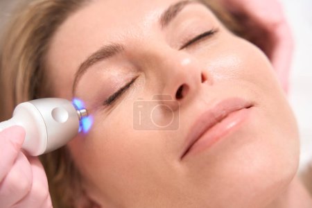 Patient undergoes an effective rejuvenating procedure of radio wave face lifting, using modern equipment