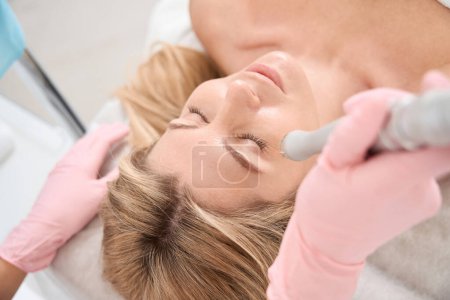 Foto de Paciente femenina en procedimiento de resurfacing de la piel del laser, hembra en guantes protectores utiliza láser de CO2 - Imagen libre de derechos