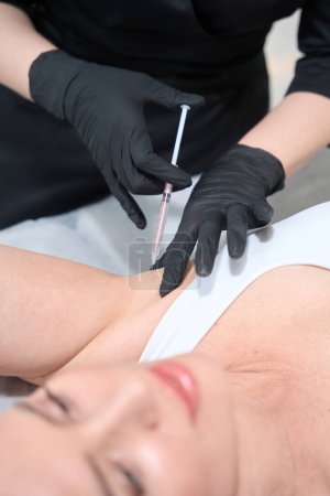 Foto de Cosmetólogo realiza un procedimiento de inyección de hiperhidrosis en las axilas de una mujer, un especialista utiliza toxina botulínica - Imagen libre de derechos