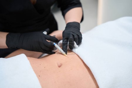Foto de Esteticista hace inyecciones en el abdomen de un cliente en una clínica de cosmetología, un especialista trabaja en guantes de protección - Imagen libre de derechos