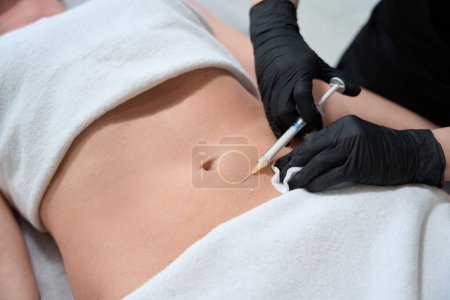 Foto de Mujer con guantes negros hace inyecciones en el vientre de un cliente, una mujer se acuesta en un sofá de cosmetología - Imagen libre de derechos