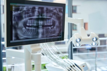 Monitor mit Röntgenbild am Arbeitsplatz eines Zahnarztes in einer modernen Klinik