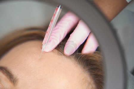 Foto de El médico hace inyecciones de belleza a la mujer en la zona frontal, el proceso del procedimiento de inyección se refleja en el espejo - Imagen libre de derechos