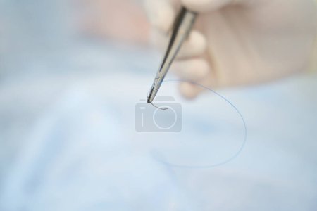 Foto de El hombre sostiene en su mano una aguja quirúrgica y material para suturar una herida postoperatoria - Imagen libre de derechos