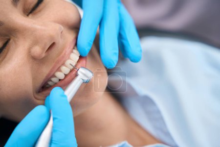 Photo for Close-up woman visiting dentist to routine health check-up, stomatologist holding drill, cleaning fissures, checking wearing away of enamel, professional treatment - Royalty Free Image