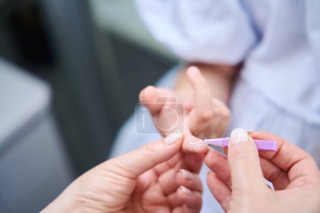 Foto de Foto recortada de manos oculistas pellizcando lente de contacto en la punta del dedo del paciente pediátrico con pinzas - Imagen libre de derechos