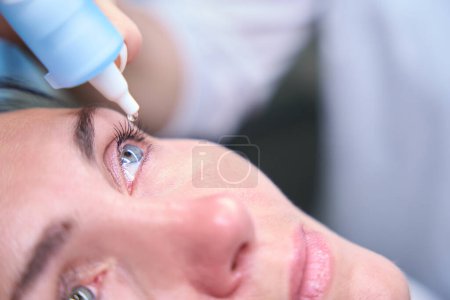 Photo for Closeup of oculist hand instilling dilating drops into eye of adult woman - Royalty Free Image