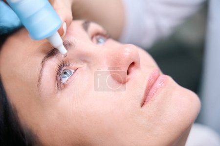 Foto de Primer plano de la mano oftalmóloga inculcando gotas dilatadoras en el ojo del paciente femenino - Imagen libre de derechos