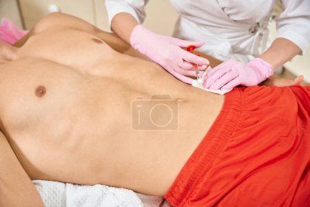 Foto de Cliente de pecho desnudo recibe inyecciones en el área abdominal, el médico utiliza una aguja delgada - Imagen libre de derechos