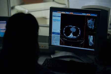 Foto de Tecnólogo radiológico sentado en el escritorio viendo las tomografías computarizadas del paciente en el monitor del ordenador - Imagen libre de derechos