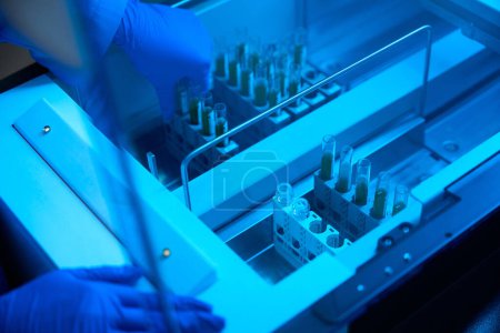 Foto de Trabajador de laboratorio utiliza equipos modernos para realizar una prueba de orina general, las muestras están etiquetadas - Imagen libre de derechos