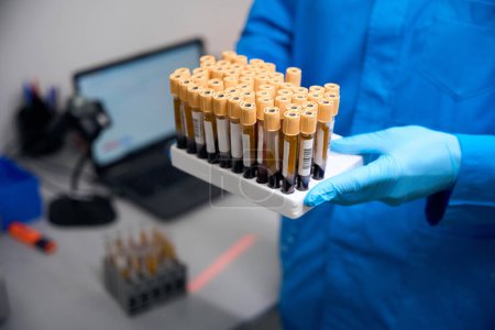 Gesundheitshelfer hält ein Set mit Reagenzgläsern mit Blutproben für Tests in den Händen, die Röhrchen sind beschriftet