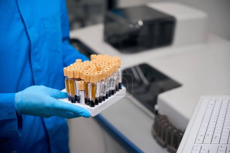 Forscher hält ein Set mit Reagenzgläsern mit Blutproben für Tests in der Hand, die Röhrchen sind beschriftet