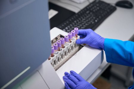 Labortechniker macht einen allgemeinen Bluttest, das Biomaterial befindet sich in speziellen Röhrchen