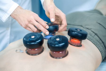 Photo for Medical cups. Experienced therapist putting medical cups on patients back - Royalty Free Image