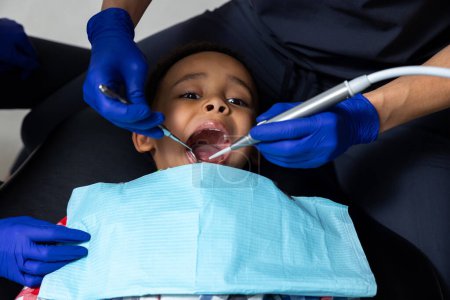 Foto de En odontología. Niño de piel oscura teniendo sesión en odontología - Imagen libre de derechos