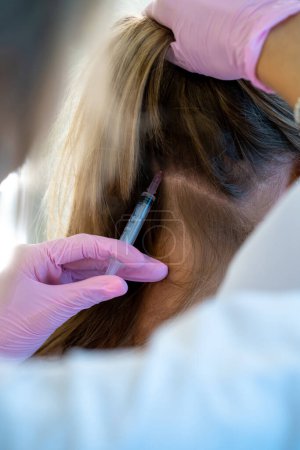Téléchargez les photos : Spécialiste de la femme professionnelle méconnaissable faisant l'injection avec une seringue dans la tête, rajeunissement, traitement de perte de cheveux. - en image libre de droit