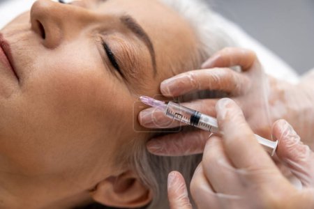Foto de Procedimientos anti edad. Mujer que tiene inyecciones de relleno antiarrugas en el área de los ojos - Imagen libre de derechos