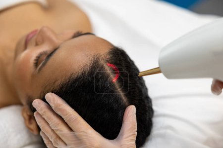 Téléchargez les photos : Soins capillaires. Client féminin ayant une séance de thérapie laser pour les cheveux dans une clinique de beauté - en image libre de droit