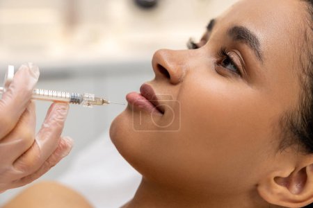 Photo for Lip care. Dark-skinned woman having hyaluronic acid injection into lips - Royalty Free Image