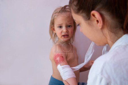 Téléchargez les photos : Blessure par brûlure chez l'enfant, traitement et guérison des brûlures, pédiatre pansant la plaie sur le bras de l'enfant avec un bandage stérile non adhésif - en image libre de droit