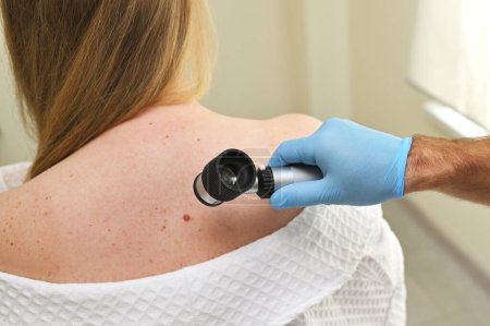 Téléchargez les photos : Un dermatologue oncologue utilise un dermatoscope pour examiner les grains de beauté et les taches de naissance sur le corps des patients. Journée du mélanome, Cancer de la peau - en image libre de droit
