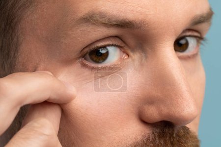 Photo for Focused man has signs of aging skin on face. Concentrated middle aged man touch face skin after cosmetology treatment injections think about wrinkles on studio background. Facial skin aging process - Royalty Free Image