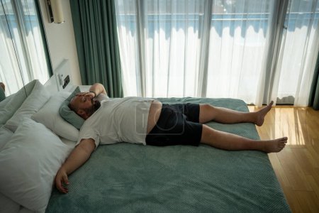 Téléchargez les photos : Homme en surpoids paresseux dormant au lit en vacances dans la chambre d'hôtel. Fatigué gars épuisé avec un excès de poids se sentent mal par temps chaud d'été au repos dans la journée. Chaleur, pression artérielle élevée, concept de fatigue. - en image libre de droit