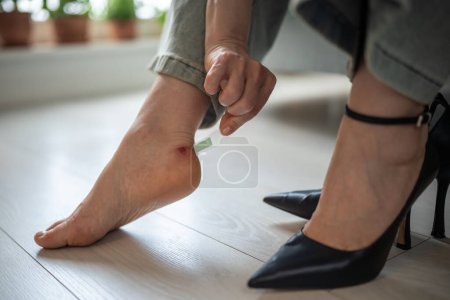 Woman carefully sticking plaster on callus on ankle. Female hands taking care of wound on foot, formed due to tight uncomfortable high heels wearing. Applying patch on painful aching corn sore.