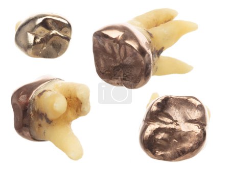 Photo for Pulled Molar Tooth with gold crown to show many angle, advanced caries rotten tweezer on root bone so dentist has to pull tooth out. Long root teeth molar on white background isolated - Royalty Free Image
