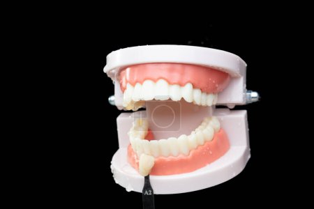 Téléchargez les photos : Dent artificielle Mâchoire en plastique vérifier comparer la couleur avec la vraie couronne. Dentiste comparer la couleur de la couronne Dents du modèle de mâchoire dentaire avant l'opération. Fond noir isolé - en image libre de droit