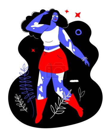 Photo for Happy life with vitiligo - colorful flat design style illustration with linear elements. Red and blue colored composition with girl with spots on the skin. Imperfect beauty and body acceptance idea - Royalty Free Image