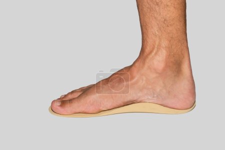 Pied sur orthèses ou semelle intérieure orthopédique pour soutenir l'arc des pieds plats sur fond blanc.