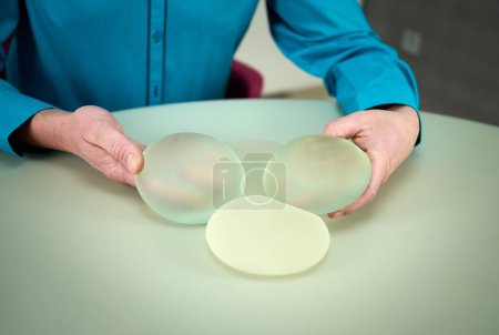 Foto de El primer plano de la cirujana plástica femenina muestra los implantes mamarios a una paciente para su nueva mama. El cirujano plástico sostiene los implantes de silicona mamaria. Concepto de aumento de senos. Muestras de implantes mamarios - Imagen libre de derechos