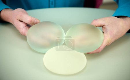 Close-up of female plastic surgeon demonstrates breast implants to a patient for her new breast. The plastic surgeon holds breast silicone implants. Breast augmentation concept. Breast Implant Samples