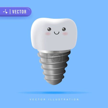 Dental Implant Vector Illustration. Orthopedic Treatment Modern Method. Vector Stomatological Illustration Isolated on Blue. 