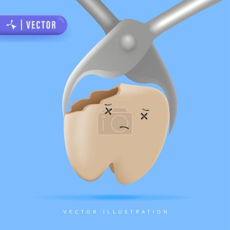 Illustration vectorielle d'extraction de dents réalistes 3D. Concept de traitement des dents et de soins dentaires.