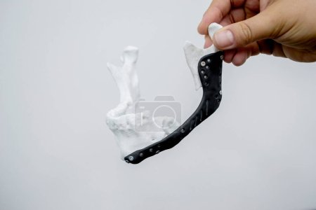 Photo for Person holding in hand 3D printed plastic prototype human lower jaw and medical titanium implant close-up. Prosthesis anatomical bone 3D printed from metal powder. Orthopedic maxillo-facial prosthesis - Royalty Free Image