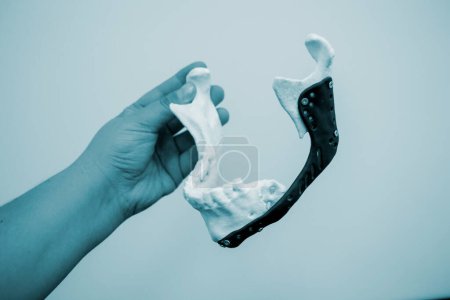 Person holding in hand 3D printed plastic prototype human lower jaw and medical titanium implant close-up. Prosthesis anatomical bone 3D printed from metal powder. Orthopedic maxillo-facial prosthesis