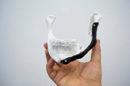 Photo for Person holding in hand 3D printed plastic prototype human lower jaw and medical titanium implant close-up. Prosthesis anatomical bone 3D printed from metal powder. Orthopedic maxillo-facial prosthesis - Royalty Free Image
