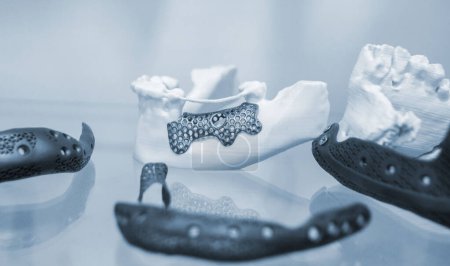Foto de Hueso facial de mandíbula humana inferior prótesis individual impresa en impresora 3D a partir de polvo metálico. Prototipo médico de titanio del hueso de la mandíbula creado por la impresora 3D en polvo. Implantación de endoprótesis - Imagen libre de derechos
