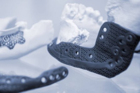 Gesichtsknochen des menschlichen Unterkiefers individuelle Prothese auf 3D-Drucker aus Metallpuder gedruckt. Medizinischer Titan-Prototyp eines Kieferknochens aus dem 3D-Drucker. Implantation von Endoprothesen