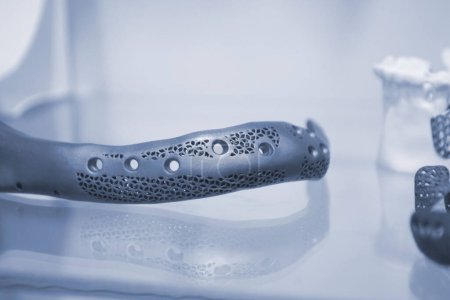 Foto de Hueso facial de mandíbula humana inferior prótesis individual impresa en impresora 3D a partir de polvo metálico. Prototipo médico de titanio del hueso de la mandíbula creado por la impresora 3D en polvo. Implantación de endoprótesis - Imagen libre de derechos